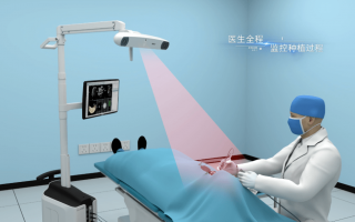 定位黒科技 患者等待时间短一点，疼痛少一点，上海医生研发无痛肺结节精准定位黑科技